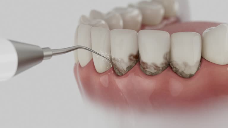 Trusted Root Canal Treatment service in Cambridge, MD - Dentist Open Now